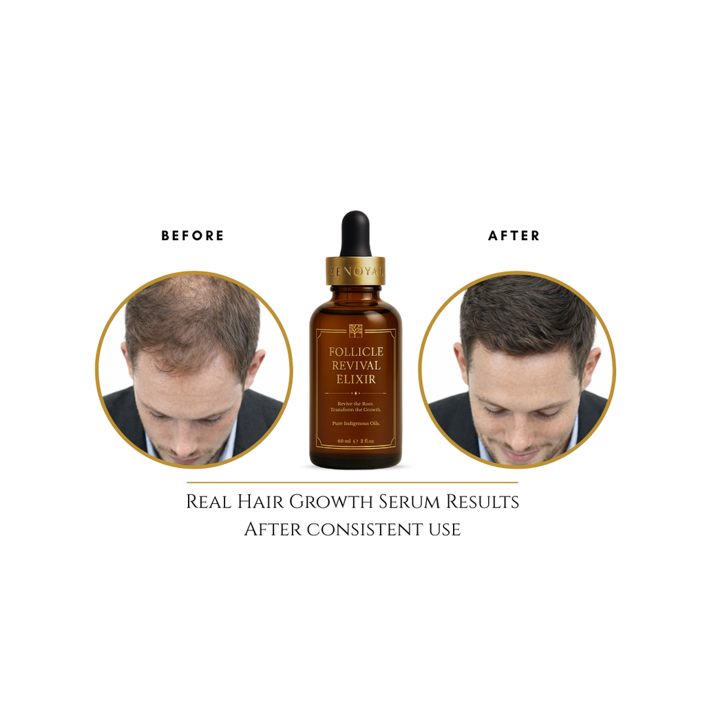 Follicle Revival Elixir